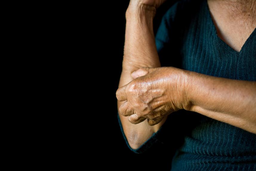 Person scratching arm